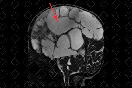 Texto alternativo para a imagem