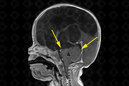 Texto alternativo para a imagem