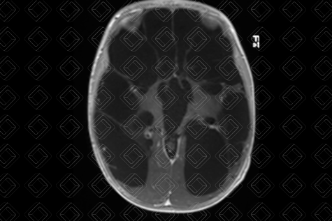 Texto alternativo para a imagem