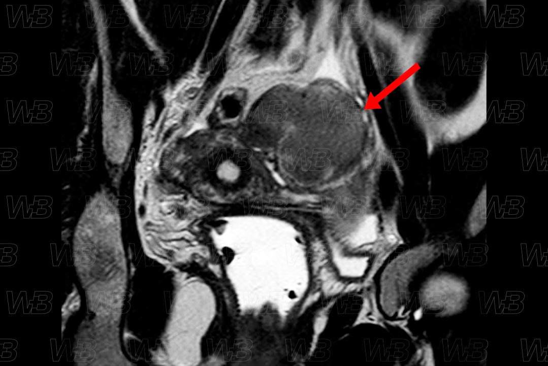 Texto alternativo para a imagem