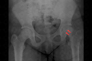 Texto alternativo para a imagem