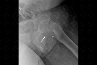 Texto alternativo para a imagem