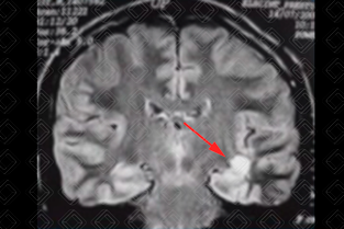 Texto alternativo para a imagem