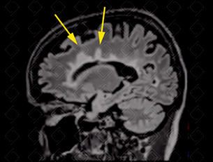 Texto alternativo para a imagem