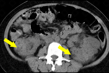 Texto alternativo para a imagem