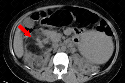 Texto alternativo para a imagem