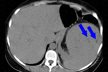 Texto alternativo para a imagem