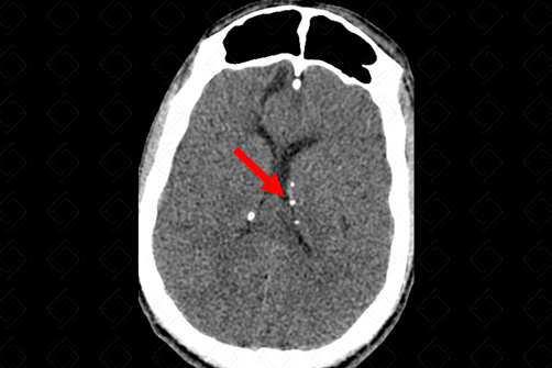 Texto alternativo para a imagem