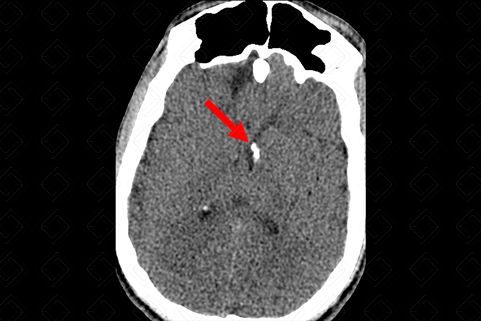 Texto alternativo para a imagem