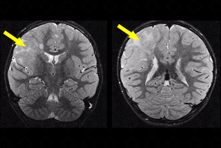 Texto alternativo para a imagem