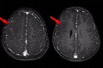 Texto alternativo para a imagem