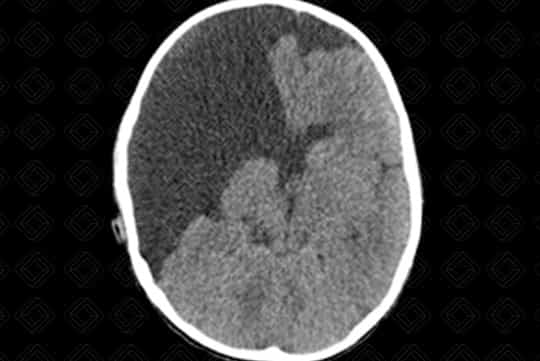 Texto alternativo para a imagem