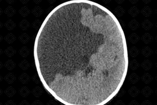 Texto alternativo para a imagem