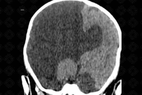 Texto alternativo para a imagem