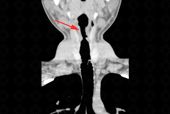 Texto alternativo para a imagem