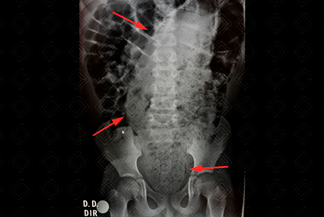 Texto alternativo para a imagem