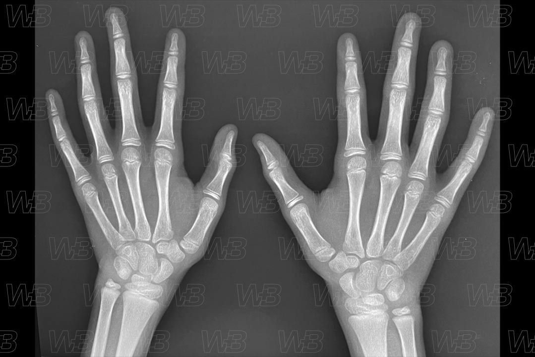 Texto alternativo para a imagem