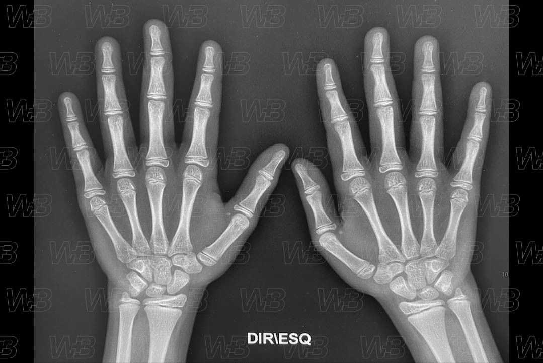 Texto alternativo para a imagem