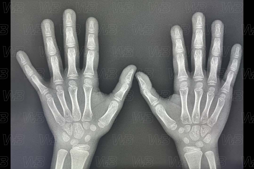 Texto alternativo para a imagem