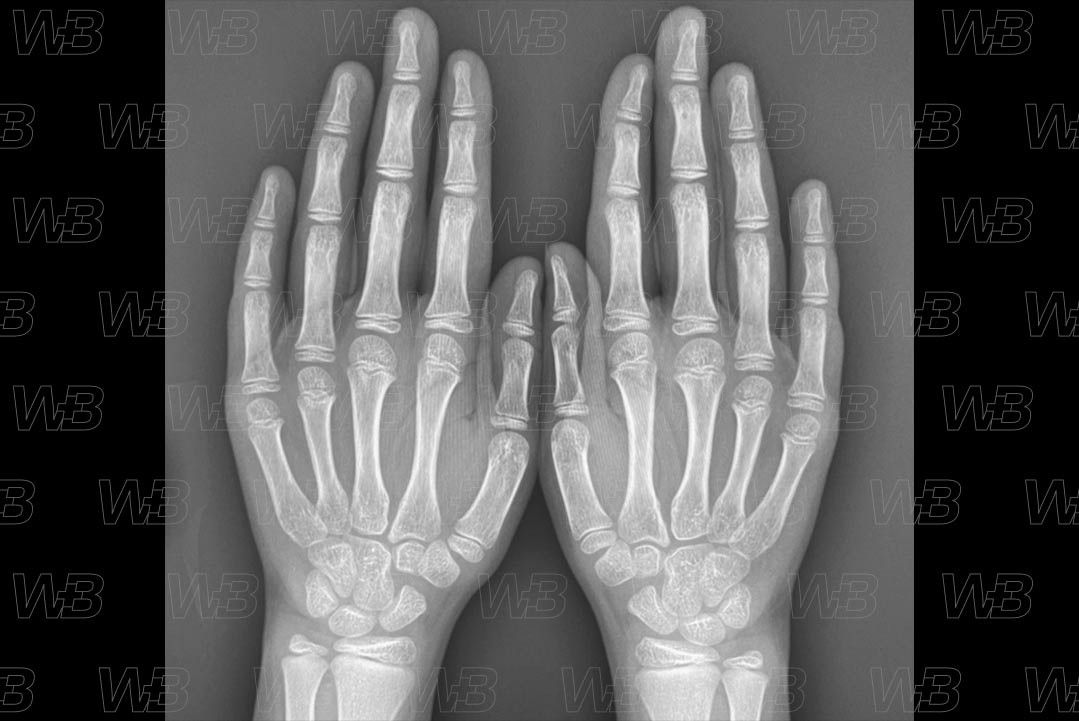 Texto alternativo para a imagem