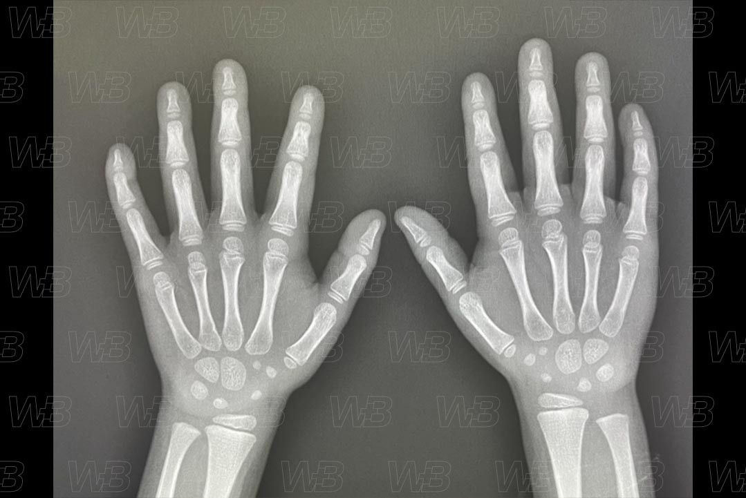 Texto alternativo para a imagem