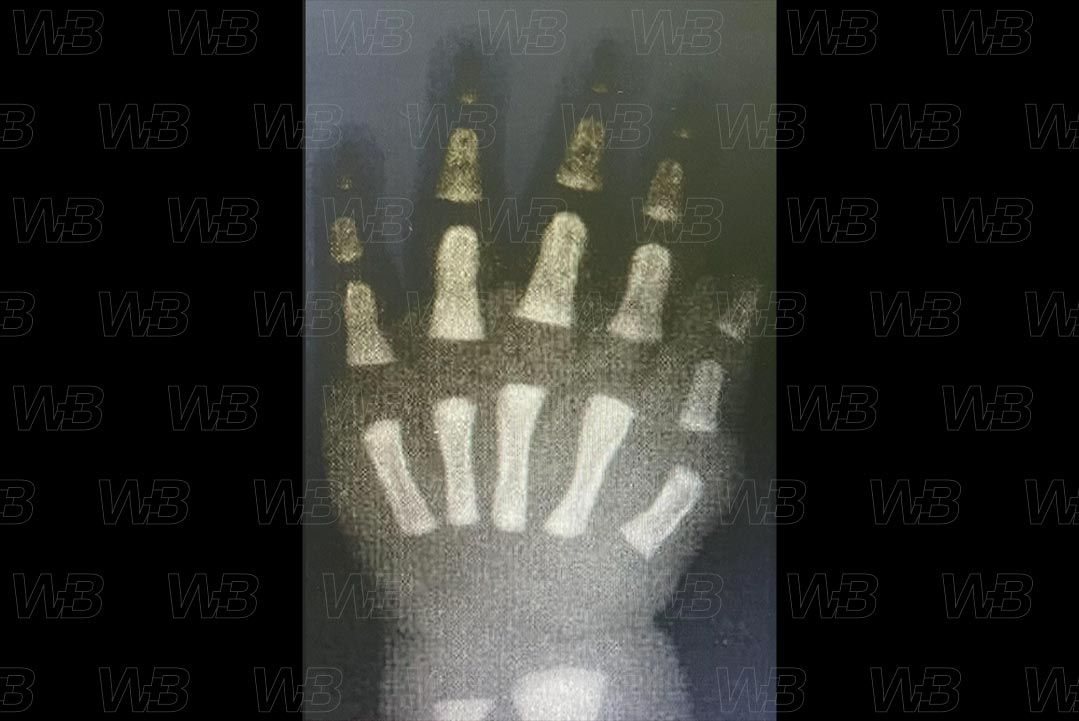 Texto alternativo para a imagem