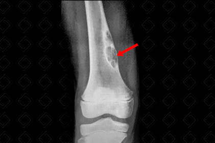 Texto alternativo para a imagem