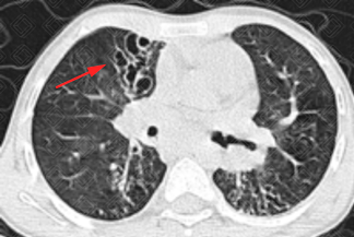 Texto alternativo para a imagem