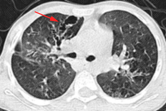 Texto alternativo para a imagem