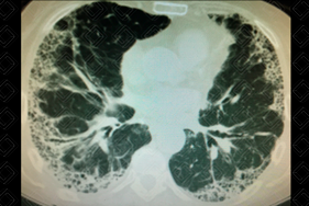 Texto alternativo para a imagem