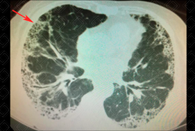 Texto alternativo para a imagem