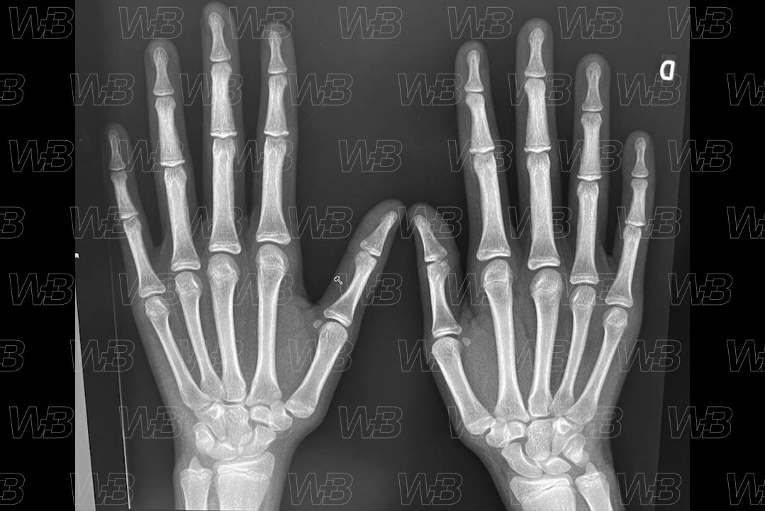 Texto alternativo para a imagem