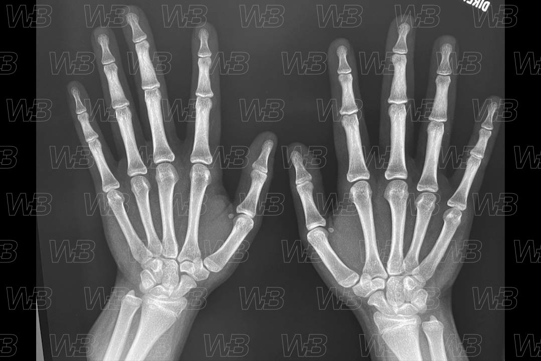 Texto alternativo para a imagem