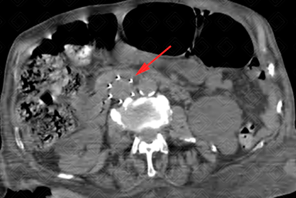 Texto alternativo para a imagem