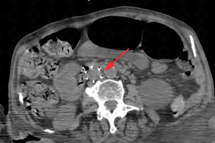 Texto alternativo para a imagem