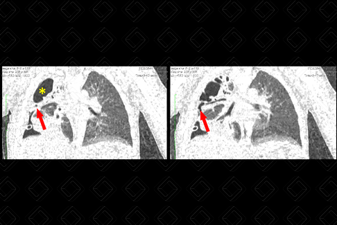 Texto alternativo para a imagem