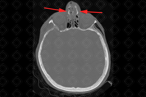 Texto alternativo para a imagem