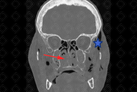Texto alternativo para a imagem