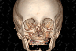 Texto alternativo para a imagem