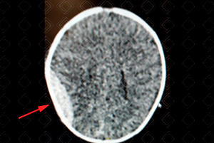 Texto alternativo para a imagem