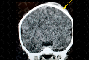 Texto alternativo para a imagem