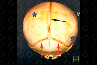 Texto alternativo para a imagem