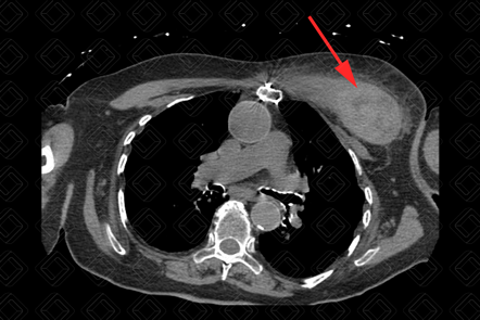 Texto alternativo para a imagem