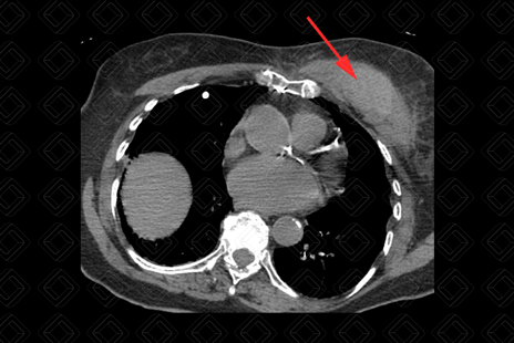 Texto alternativo para a imagem