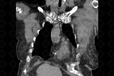 Texto alternativo para a imagem