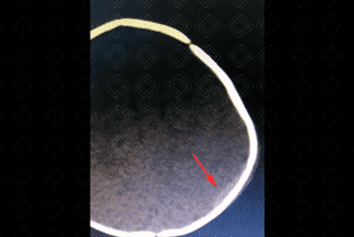 Texto alternativo para a imagem