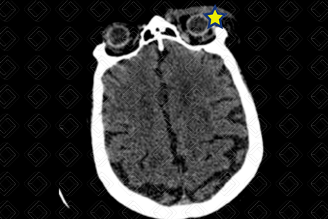 Texto alternativo para a imagem