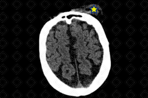 Texto alternativo para a imagem