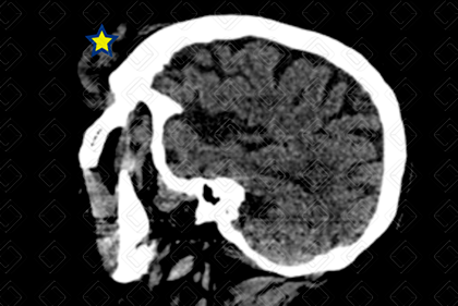 Texto alternativo para a imagem