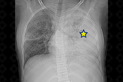 Texto alternativo para a imagem